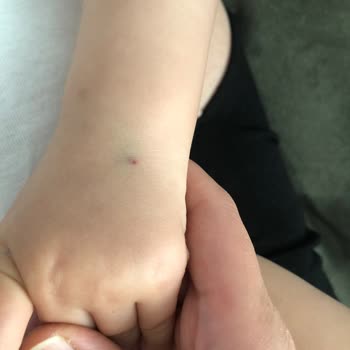 Özel Malatya Park Hastanesi Yetersizliği