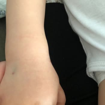 Özel Malatya Park Hastanesi Yetersizliği