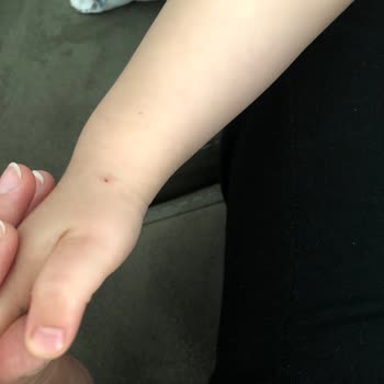 Özel Malatya Park Hastanesi Yetersizliği