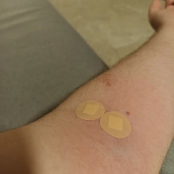 Medical Park İnsan Sağlığıyla Oynuyor Kolum Duvar Gibi Oldu