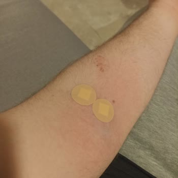 Medical Park İnsan Sağlığıyla Oynuyor Kolum Duvar Gibi Oldu