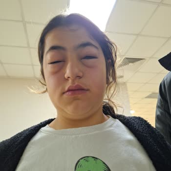 Kanuni Sultan Süleyman Eğitim Araştırma Hastanesi Yanlış İlaç Yanlış Tedavi