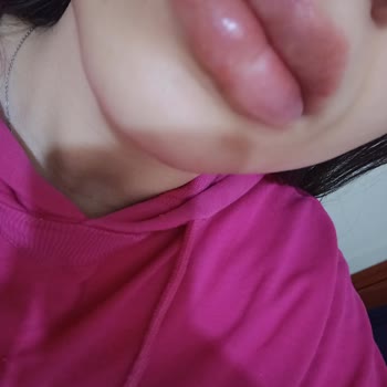 Flormar Water Lip Stain Dudaklarımda İltihaplı Uçuk Çıkardı