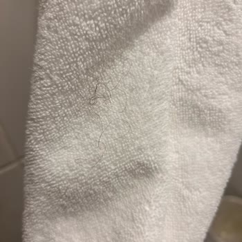 Novotel Kayseri Hizmet Kötü Havlular Pis