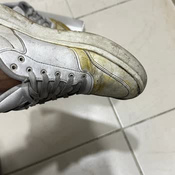 Adidas Hatalı Ürününü Kabul Etmiyor