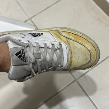 Adidas Hatalı Ürününü Kabul Etmiyor