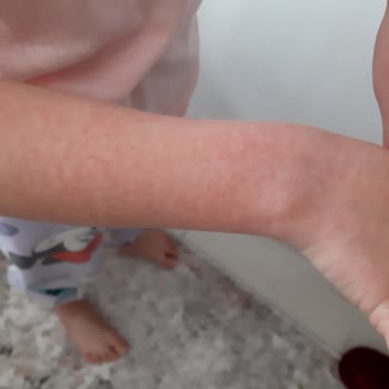 Bee Beauty Çilekli Duş Jeli Kaşınma Ve Döküntüler