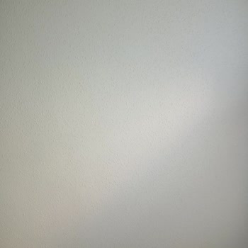 Songül Alcı Saç Ekimi Saç Ekimi Sürecinde Yaşanan Hayal Kırıklıkları