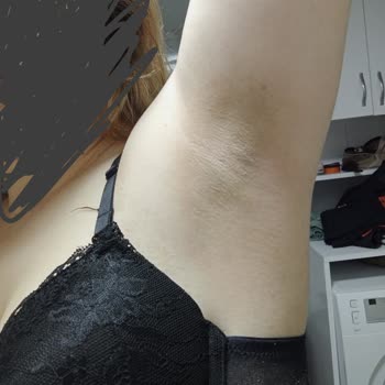 Nivea Black And White Deodorant Koltuk Altımı Kapkara Yaptı