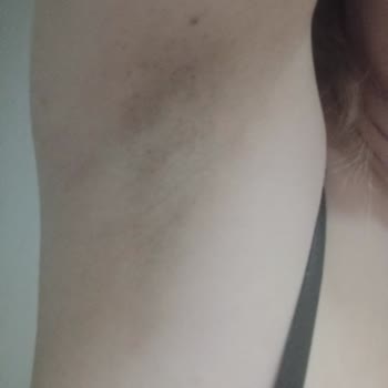 Nivea Black And White Deodorant Koltuk Altımı Kapkara Yaptı