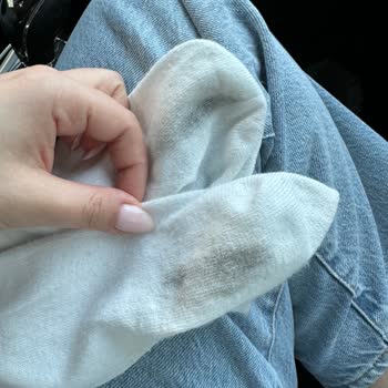 Adidas Ayakkabılarım Ayaklarımı Boyuyor