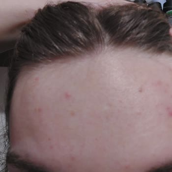 Yves Rocher Sebo Pure Vegetal