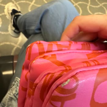 Boyner'den Alınan Versace Marka Çantanın Derisi Soyulmaya Başladı