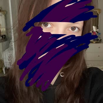 iPhone 15 Promax Kamera Sorunu