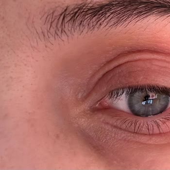 Bioderma Atoderm Egzama Tetikliyor Olabilir Mi