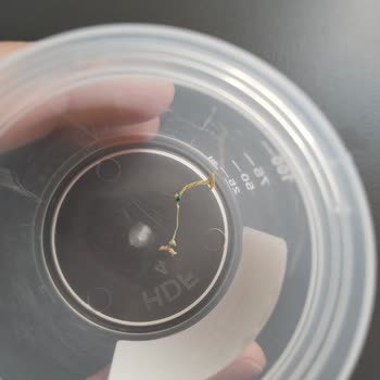 Medistanbul Hastanesi Sağlıkta Güvensizlik: Menisküs Ameliyatı Mağduriyeti