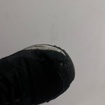 Skechers Ayakkabı Sorunu