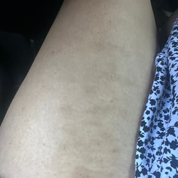 Gülnihal Kaya Güzellik Merkezi Hem Yandım, Hem Paramdan Oldum, Hem Tüyüm Dökülmedi