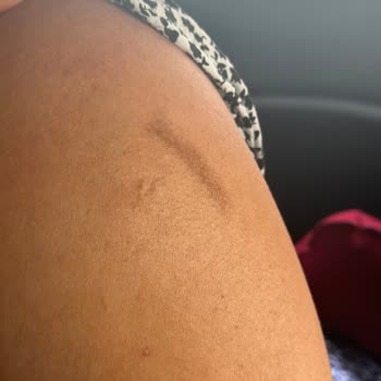 Gülnihal Kaya Güzellik Merkezi Hem Yandım, Hem Paramdan Oldum, Hem Tüyüm Dökülmedi