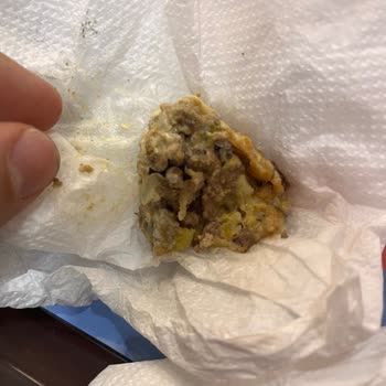 Burger King Hamburger İçerisinden Sert Cisim Çıktı!