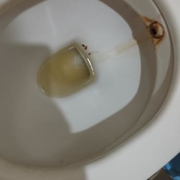 Sefa Termal Özbudak Termal Afyonda Pisliğinden Mikrop Kaptık