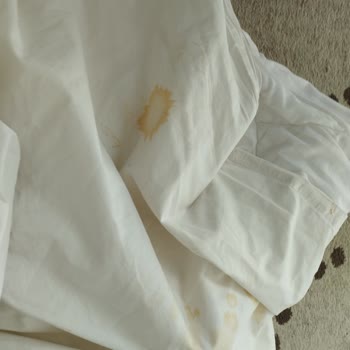 Sefa Termal Özbudak Termal Afyonda Pisliğinden Mikrop Kaptık