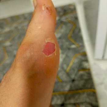 Mizuno Marka Kramponun Kalitesizliği