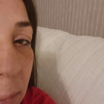 Yves Rocher Göz Altı Ve Serum Alerjisi Hk.