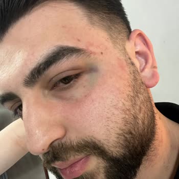 Emniyet Genel Müdürlüğü Yunus Polisi Darp Etti