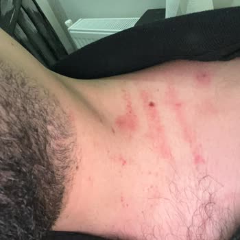 Emniyet Genel Müdürlüğü Yunus Polisi Darp Etti