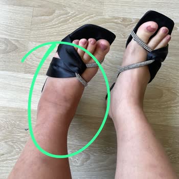 Climed Tedavi Merkezi Tedavi Sonrası Hayatım Mahvoldu!