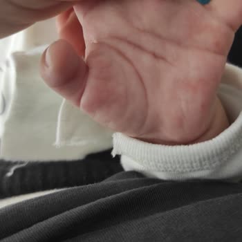 Özel Optimed Hastanesi Optimed Çerkezköy Hemşire Şikayet