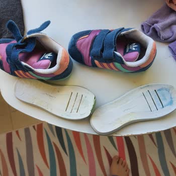 Adidas Ayakkabının Altı Çıktı