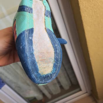 Adidas Ayakkabının Altı Çıktı