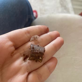 Nestle Damak İçinde Silikon