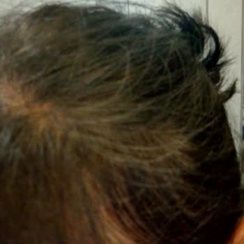 Gratis Bee Beauty Kuru Şampuan Kalitesizliği