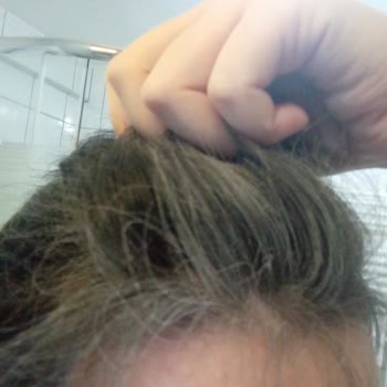 Gratis Bee Beauty Kuru Şampuan Kalitesizliği