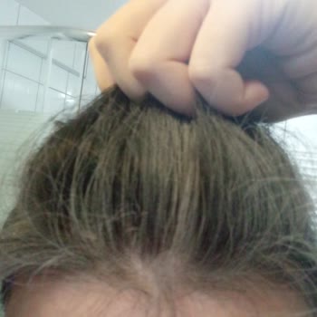 Gratis Bee Beauty Kuru Şampuan Kalitesizliği