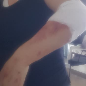 World Deluxe Sapanca Misafir Güvenliğini Umursamayan Bir Tesis