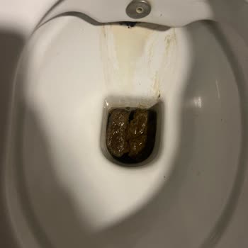 Grand Ocakoğlu Hotel Otelde Yaşanılan Mağduriyet