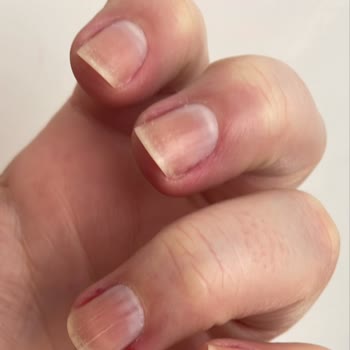 Gratis Beauty Hatalı Manikür, Pedikür, Eğitimsiz, Deneyimsiz Personel