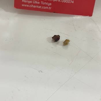 BİM Soğuk Baklava Şikayeti