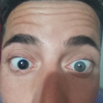 Dünya Göz Hastanesi Gözümü Bozdu, Arkasında Durmadılar!