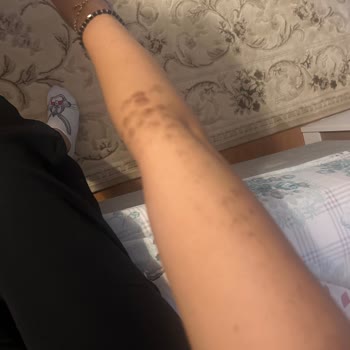 Sade Derma Estetik Sade Derma Lazer