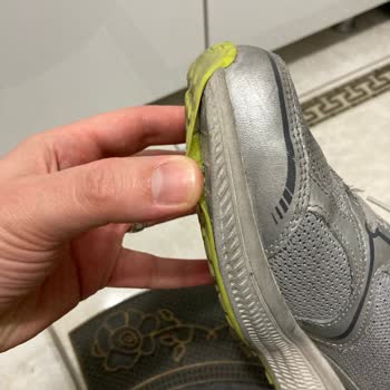 Skechers Ayakkabı Pişmanlığı Ürünlerinin Arkasında Durmayan Firma