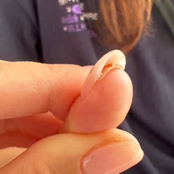 Nuka Beauty Center Kötü Tırnak