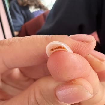 Nuka Beauty Center Kötü Tırnak