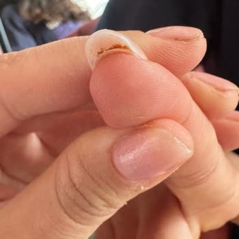 Nuka Beauty Center Kötü Tırnak