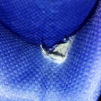 Skechers Ayakkabı İç Topuk Aşınması