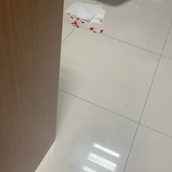 Akdeniz Sağlık Vakfı Yaşam Hastanesi Onayım Olmadan İşlem Yapıp Burnumu Kanattılar